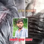 पाचपीर नगर येथे एकास तलवारीने डोक्यात मारहाण; पायाचेही हाड तोडले.