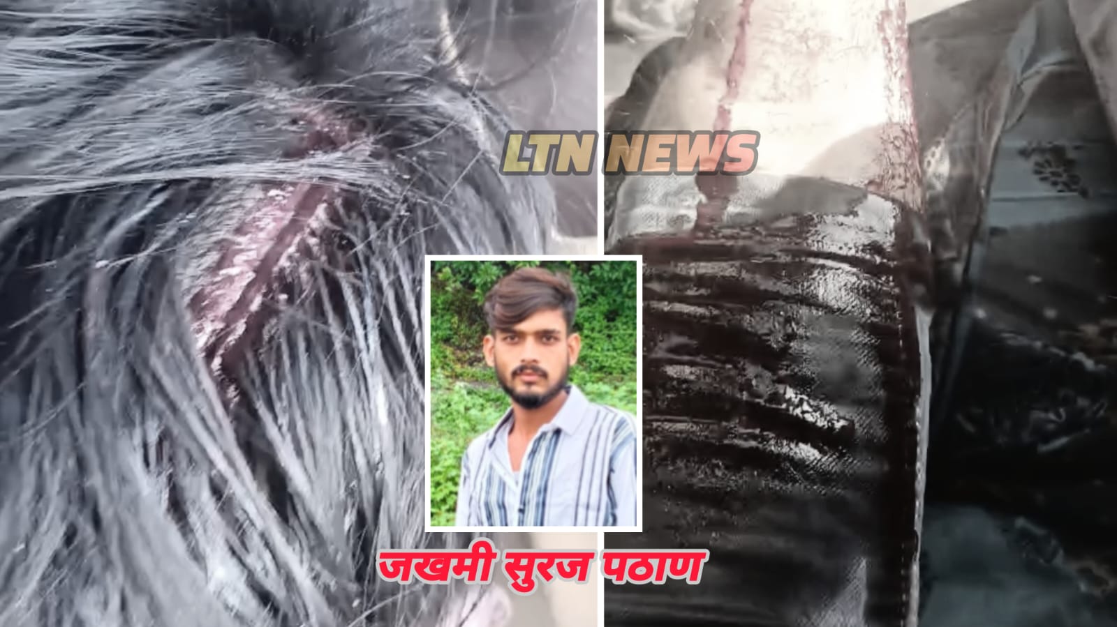 पाचपीर नगर येथे एकास तलवारीने डोक्यात मारहाण; पायाचेही हाड तोडले.