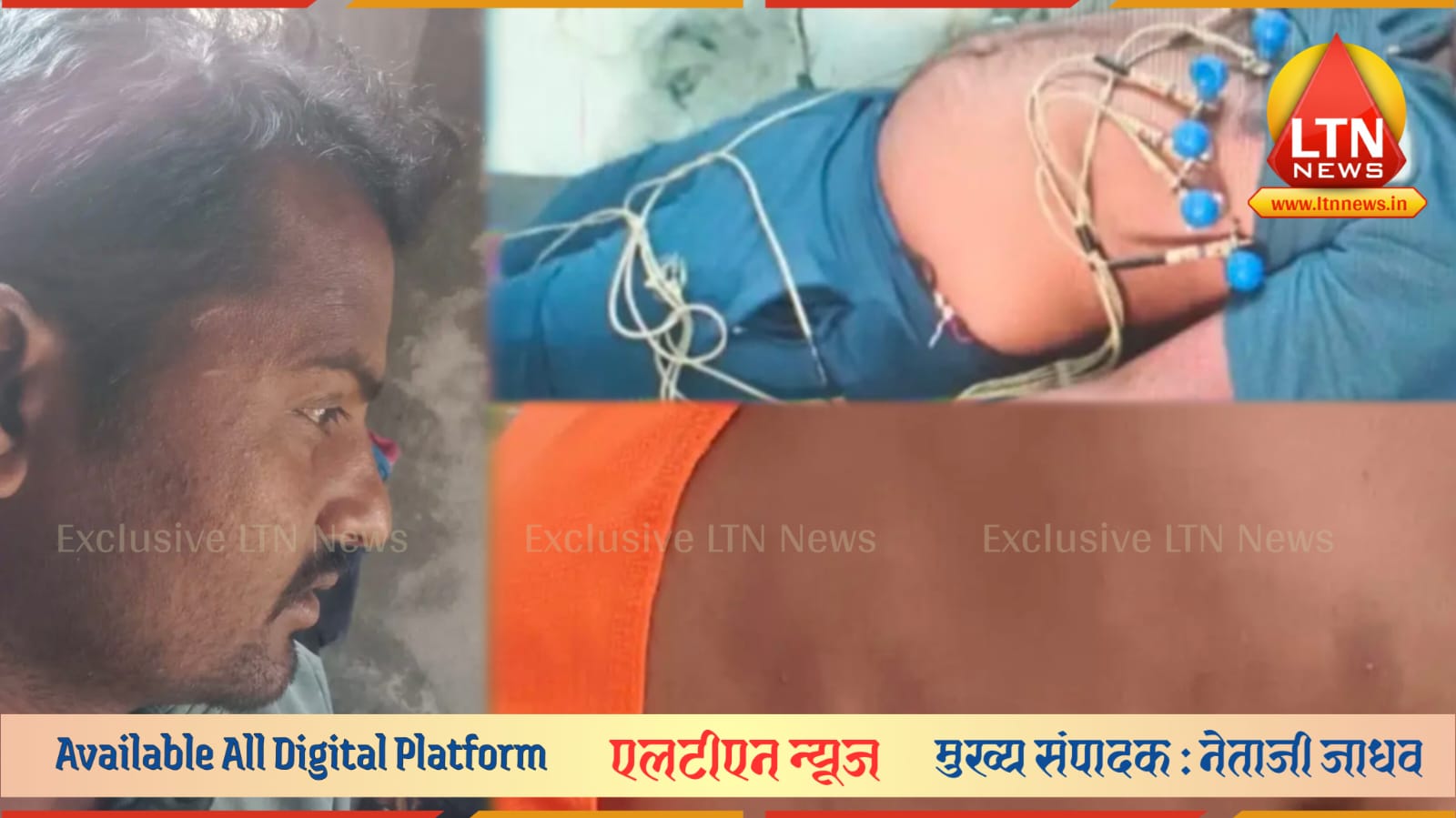 खाकी डागाळली! लातूरमध्ये पोलिसांकडूनच तरुणाला बेदम मारहाण; "एस.पी. साहेबांना तक्रार केली तर ठार मारू" अशी धमकी.